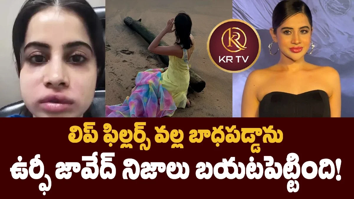లిప్ ఫిల్లర్స్ వల్ల బాధపడ్డాను – ఉర్ఫీ జావేద్ నిజాలు బయటపెట్టింది!